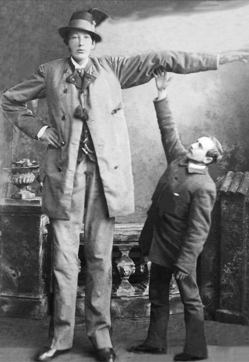 Franz Winkelmeier - Tallest human in European history